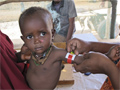 Καταυλισμός Dadaab-Κένυα: Στο κόκκινο ο υποσιτισμός © Serene Assir/MSF